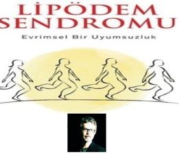 Kilo Veremiyorsanız Suçlu İradeniz Değil, Lipödem Olabilir