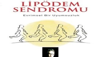 Kilo Veremiyorsanız Suçlu İradeniz Değil, Lipödem Olabilir