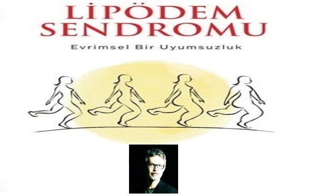 Kilo Veremiyorsanız Suçlu İradeniz Değil, Lipödem Olabilir