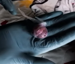 Çanakkale’de Zehir Tacirlerine Ağır Darbe