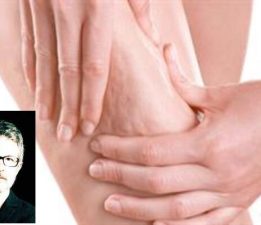 Prof. Dr. Ahmet Karacalar: “Selülit Sadece Selülit Değildir; Metabolik Bir Aynadır”