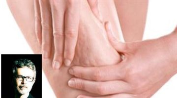 Prof. Dr. Ahmet Karacalar: “Selülit Sadece Selülit Değildir; Metabolik Bir Aynadır”