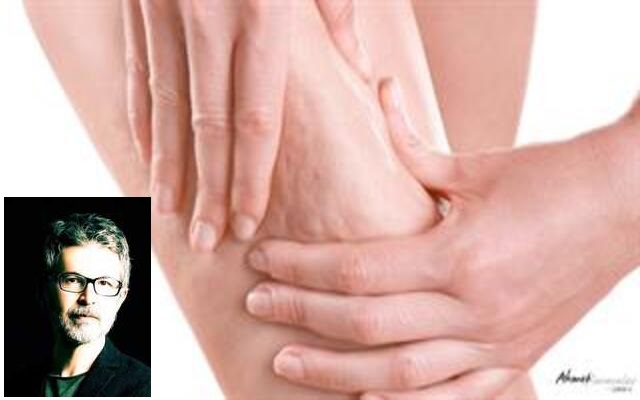 Prof. Dr. Ahmet Karacalar: “Selülit Sadece Selülit Değildir; Metabolik Bir Aynadır”