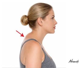 Gözden Kaçan Tehlikeli Yağ: Ense Hörgücü