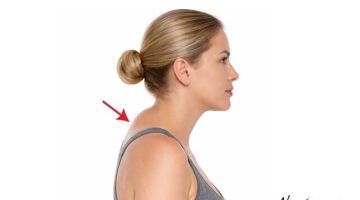 Gözden Kaçan Tehlikeli Yağ: Ense Hörgücü