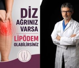 Nedeni Bilinmeyen Diz Ağrılarının Altından ‘Lipödem’ Çıkabilir