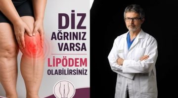 Nedeni Bilinmeyen Diz Ağrılarının Altından ‘Lipödem’ Çıkabilir
