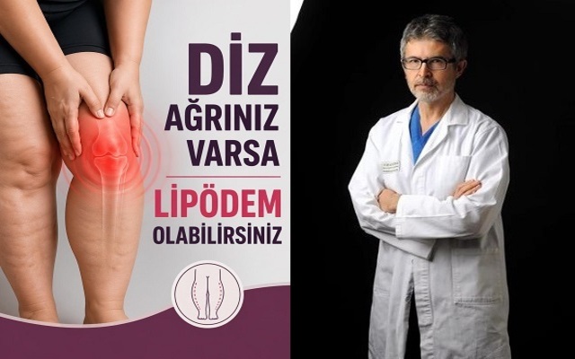Nedeni Bilinmeyen Diz Ağrılarının Altından ‘Lipödem’ Çıkabilir