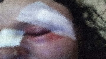 Köpek Saldırısı Sonucu Anne ve Oğlu Yaralandı
