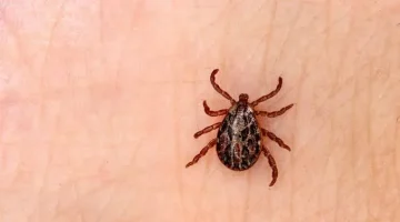 Sivas’ta KKKA şüphesiyle tedavi gören kadın hayatını kaybetti