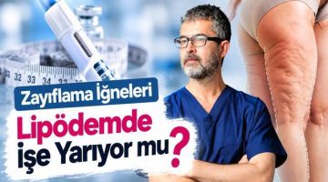 Zayıflama İğneleri Lipödemde İşe Yarıyor mu?