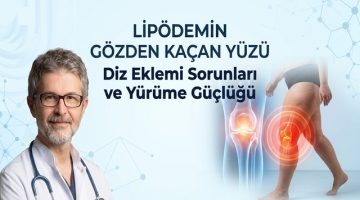 Diz Eklemi Sorunları ve Yürüme Güçlüğü